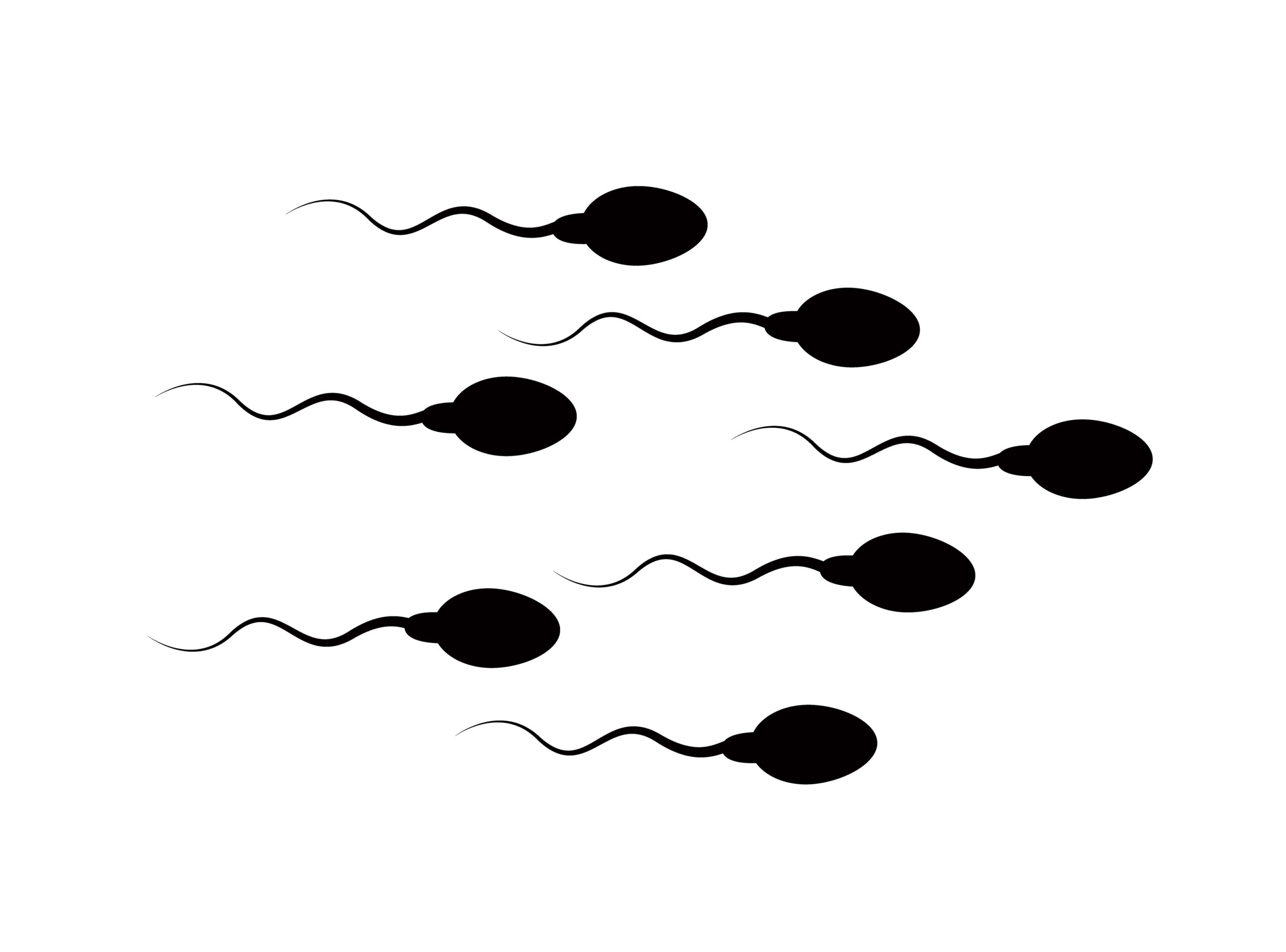 Where Does The Sperm Go After a Vasectomy?