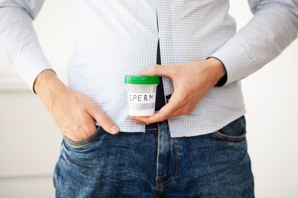semen test after a vasectomy